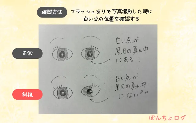 医療機関で教えてもらった斜視の確認方法